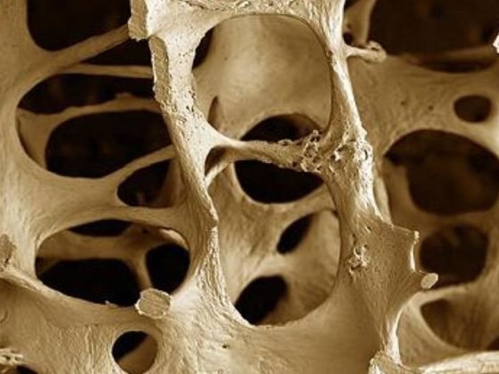 Zaboravite lijekove za osteoporozu - izgradite zdrave kosti na prirodan način - Osteoporoza - Zdrava Alternativa - zdravaalternativa.online